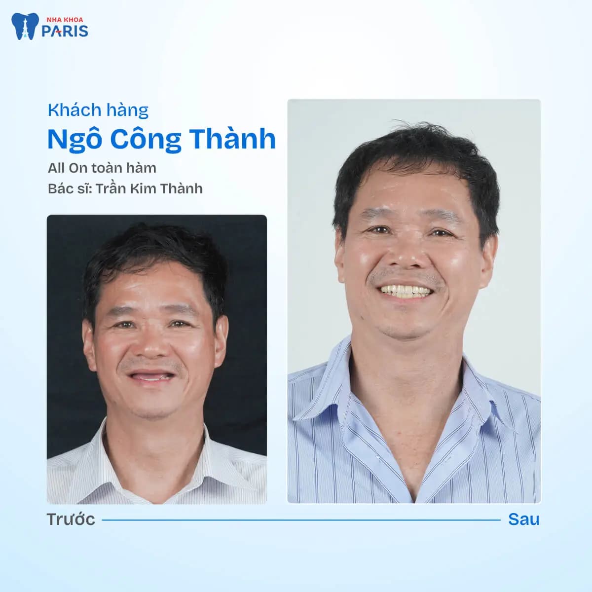 Hình ảnh Nha khoa Paris