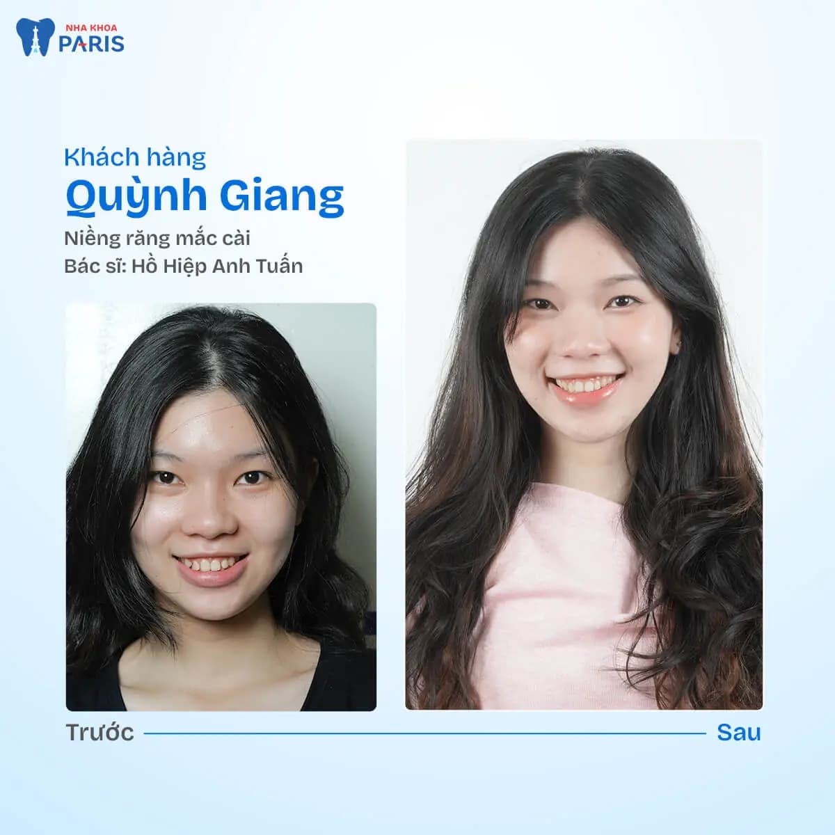 Nha khoa Paris — ảnh 5