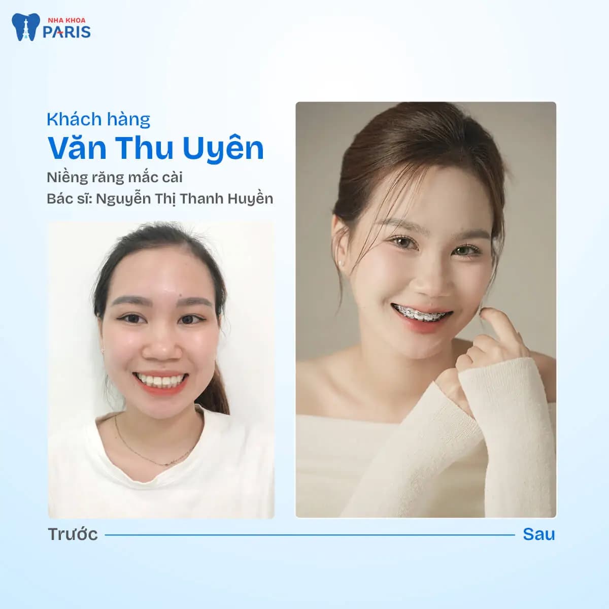 Nha khoa Paris — ảnh 6