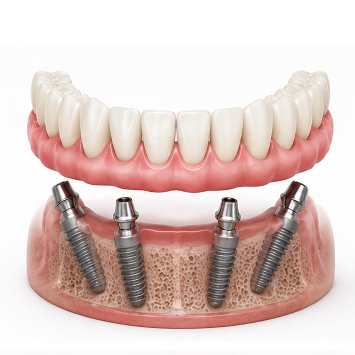 Hình ảnh Saigon Implant Center