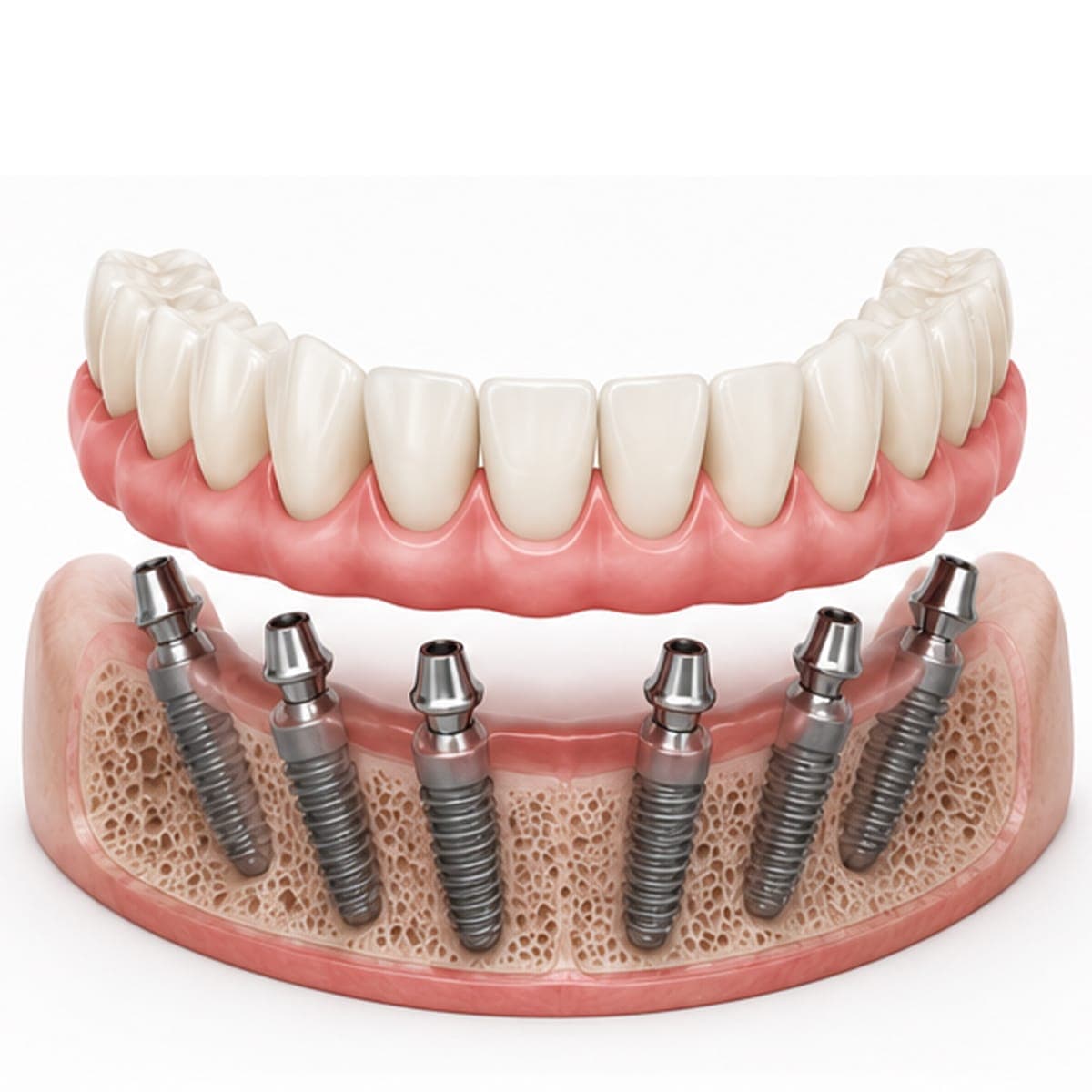 Saigon Implant Center — ảnh 2