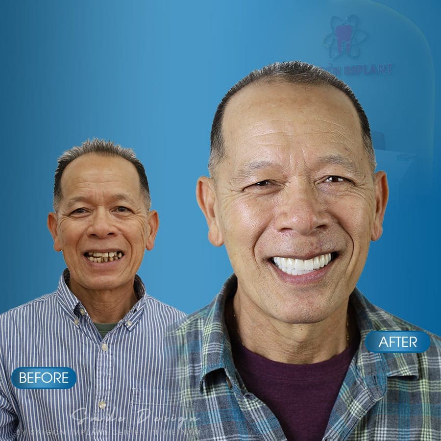 Saigon Implant Center — ảnh 6