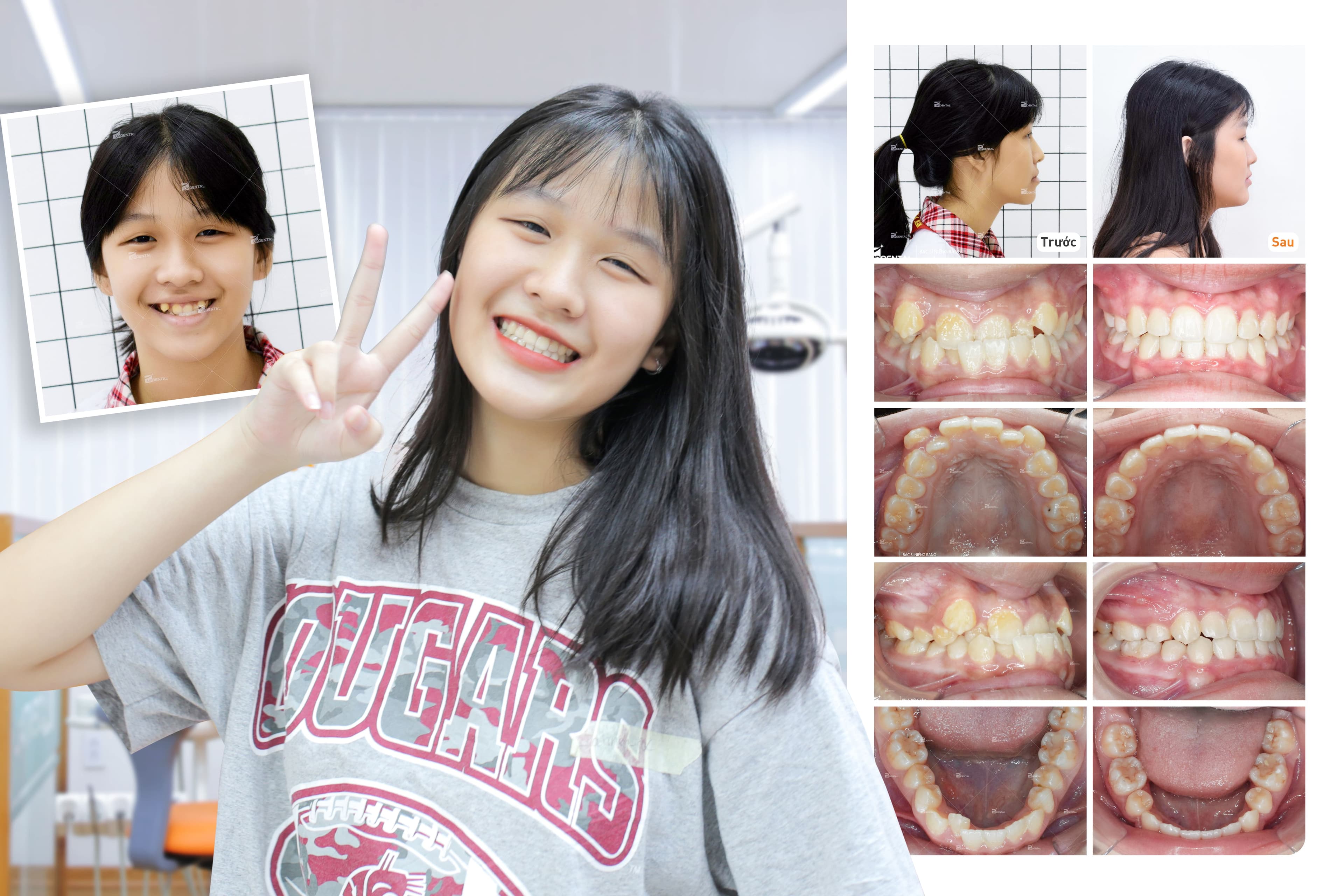Hình ảnh Up Dental