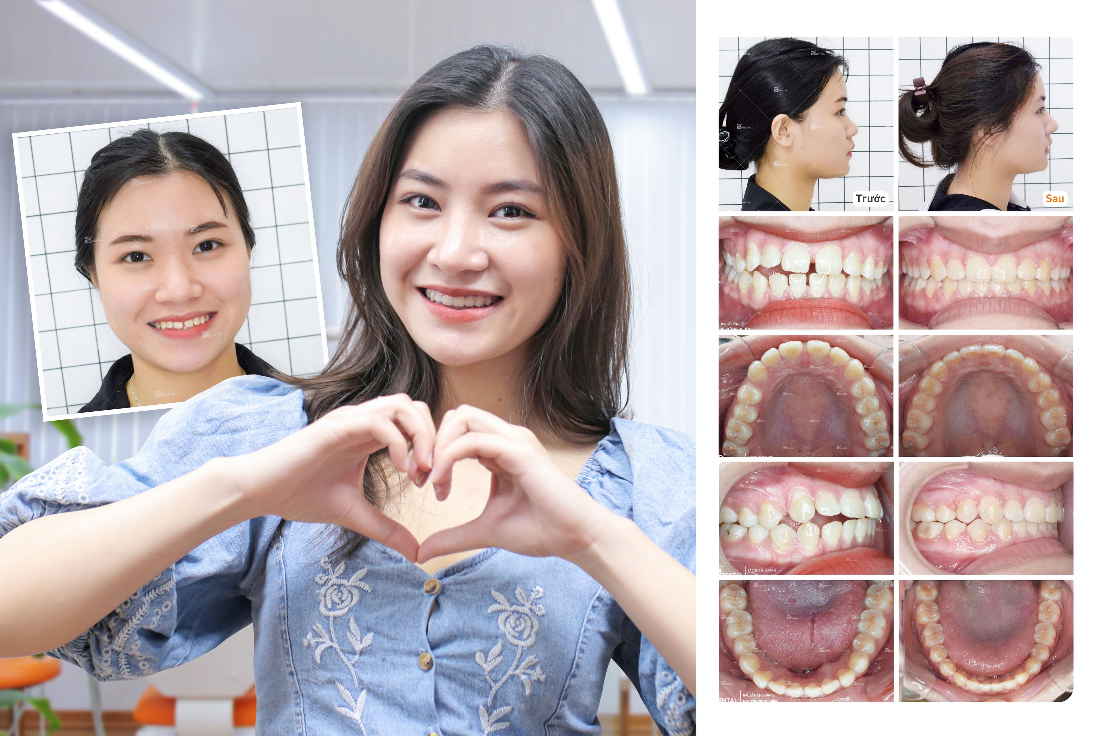 Up Dental — ảnh 4