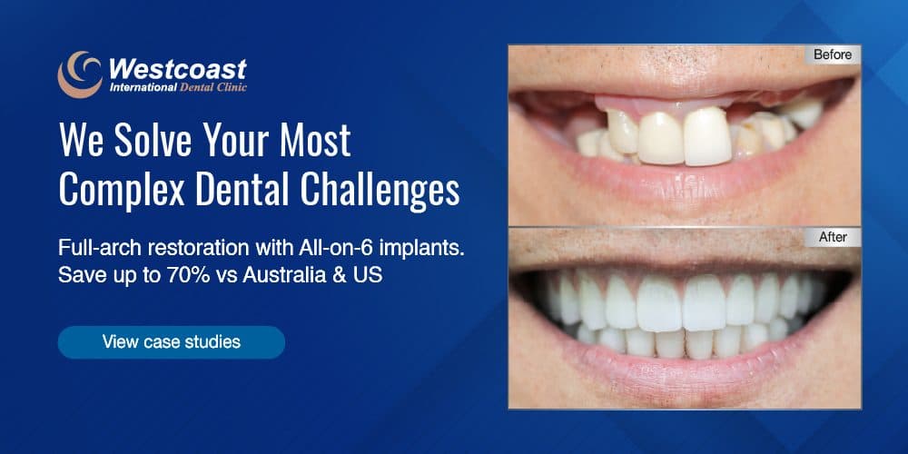 Hình ảnh Westcoast International Dental Clinic